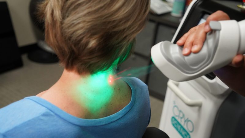 Cold laser therapy treatment at Spring Chiropractic